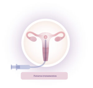 embriões-excedentários-tratamentos