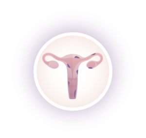 útero-doença-aparelho-reprodutor