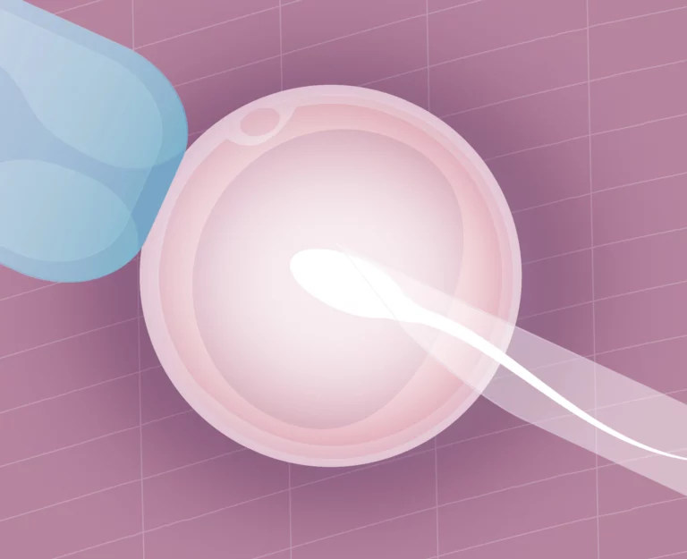 Fertilização-In-Vitro