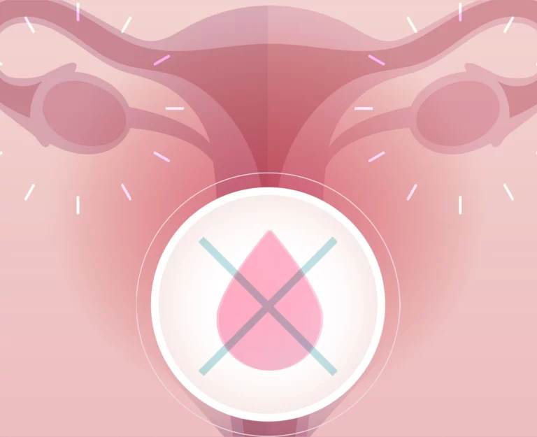 dor-nos-ovários-sem-menstruação